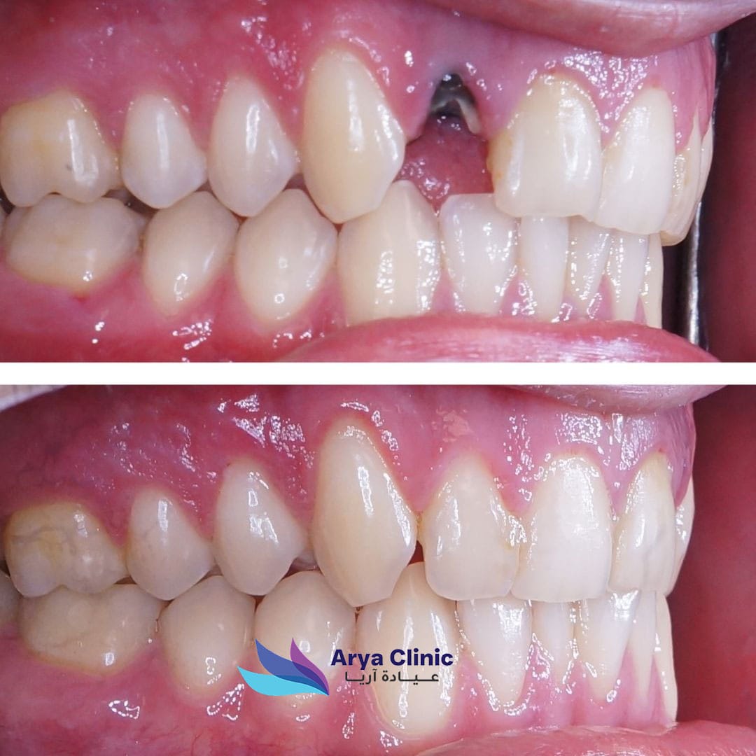 Dental-Before-and-After-1-1.jpg