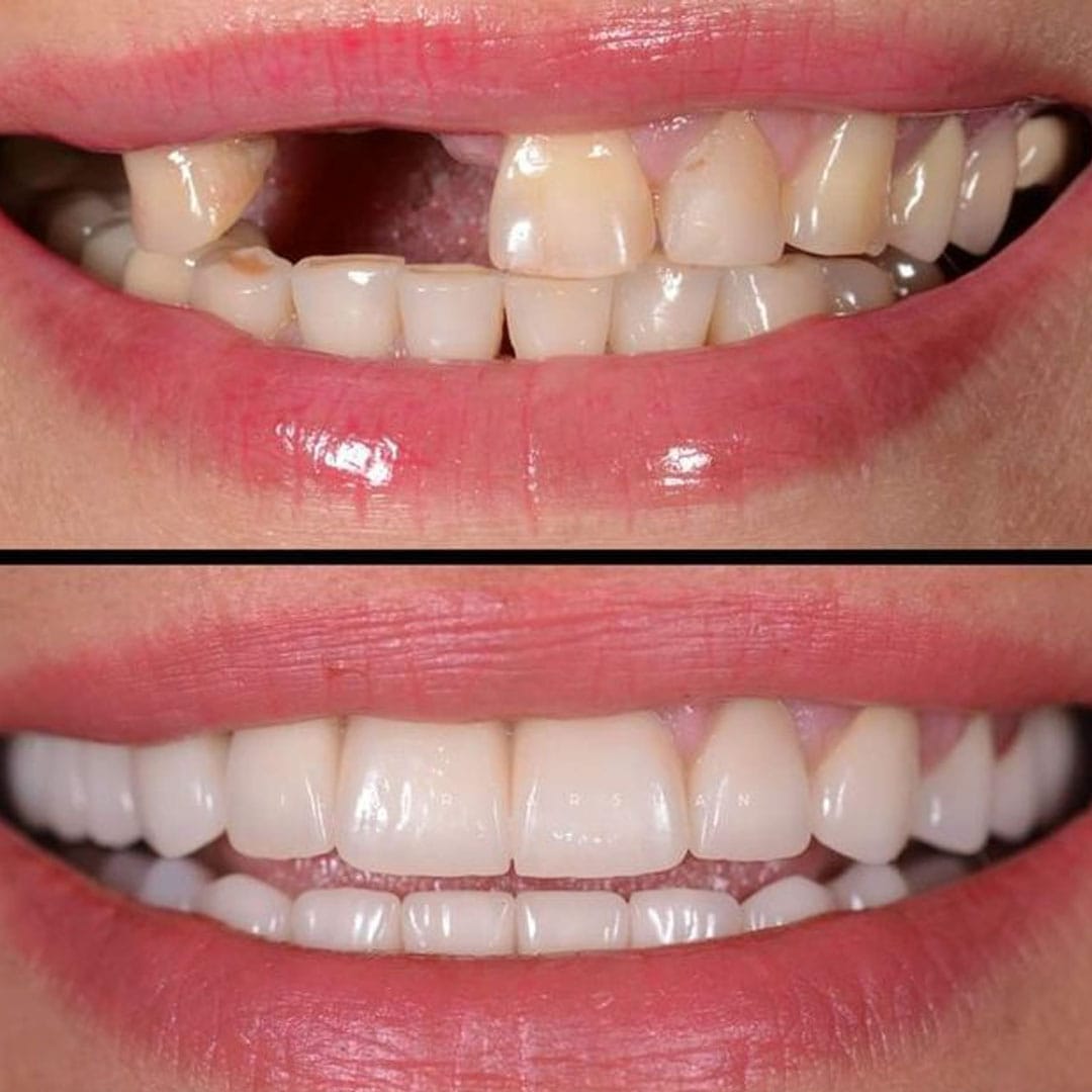 Dental-Before-and-After-1.jpg