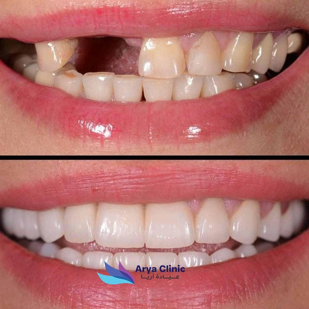 Dental-Before-and-After-3.jpg