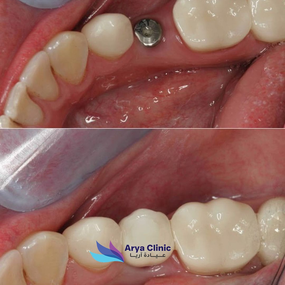 Dental-Before-and-After-4.jpg