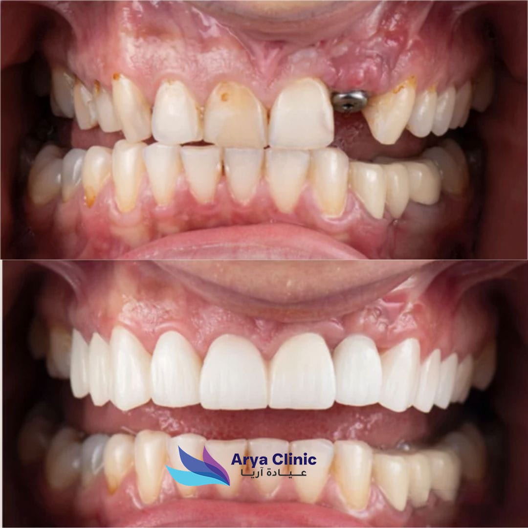 Dental-Before-and-After-5.jpg